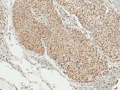 Immunohistochemistry: alpha-Synuclein [p Ser129] Antibody [NBP2-61121]